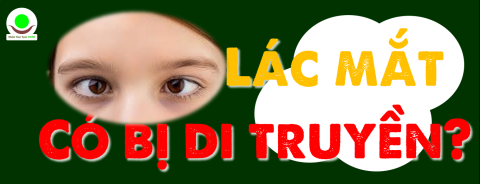 Bị Lác (lé) mắt Có Di Truyền Không? Kiểu Lác Lé như nào thì có bị di truyền