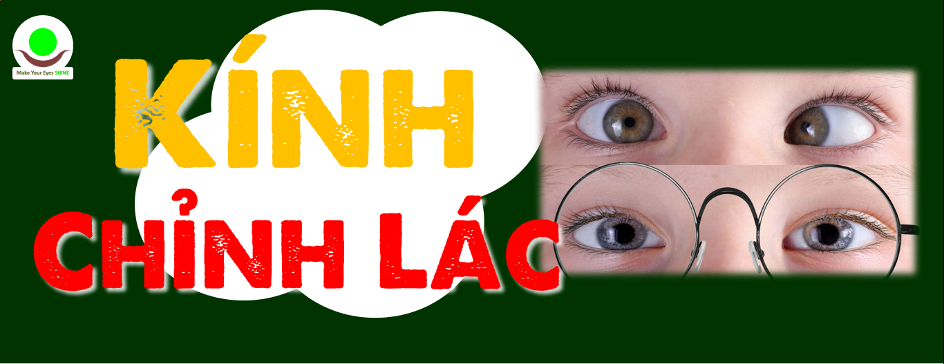 Kính Chỉnh Lác (Lé) Có Thực Sự "Chữa Khỏi" Được Lác? Phân Tích Chuyên Sâu 3 Phương Pháp Phổ Biến